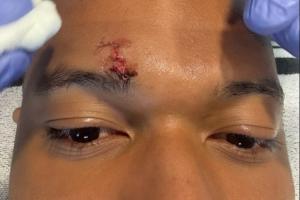 西甲网络高清直播